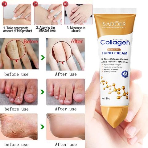 Kem Dưỡng Da Tay Collagen 30g - Dưỡng Ẩm, Làm Trắng Da, Chống Lão Hóa Cho Làn Da Mềm Mại, Tươi Trẻ