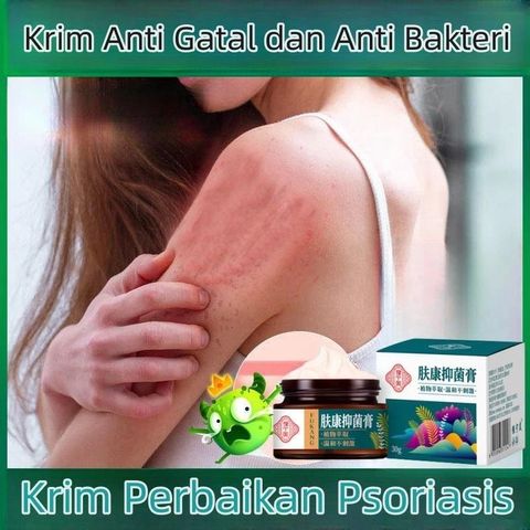 Kem chống ngứa kem kháng khuẩn chống dị ứng khỏi tận gốc viêm da bệnhh chàm Ngứa da nấm da nấm mụn nước tổ đỉa 30g