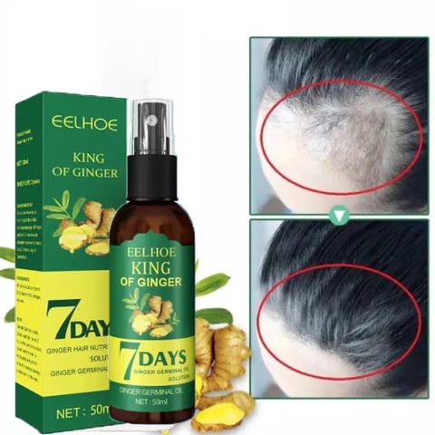 kích thích mọc tóc nhanh làm dày Chiết xuất hoàn toàn từ thiên nhiên không có tácc dụngg phụ giúp giảm rụng tóc