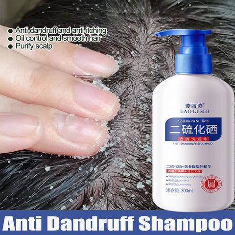 Dầu gội sạch gàu Dầu Gội gội loại bỏ mạt dầu gội giảm ngứa 300ml Làm sạch sâu da đầu, loại bỏ ve, loại