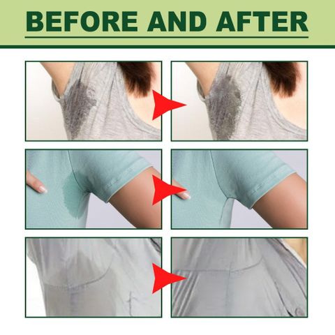 Kem Hôi Nách Chính Hãng - Khử Mùi Hôi Nách - Ngăn Tiết Mồ Hôi - Giảm Thâm-Underarm Deodorant Cream