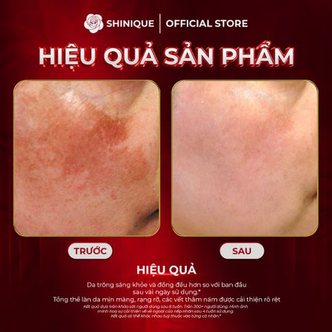 SHINIQUE MELA Skin Whitening Cream - Kem Dưỡng Da Hỗ Trợ Cải Thiện Nám và Không Đều Màu, Dưỡng Sáng Da - 30g