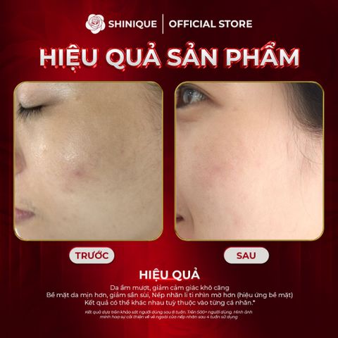 SHINIQUE Miraculous Anti-Wrinkle Moisturizer Cream - Kem Dưỡng Da Ban Đêm với PDRN & 5 Peptide, Phức Hợp 8 Loại HA 50ml