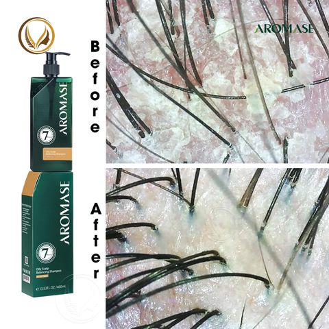 Dầu gội ngăn gàu, giảm nhờn da đầu và ngăn bết tóc AROMASE Oily Scalp Balancing Shampoo 400ml