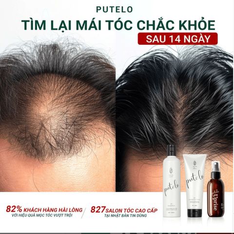 Bộ dầu gội & xả thực vật, trẻ hóa da đầu, giảm rụng, hỗ trợ mọc tóc – Putelo AR – Chính hãng Nhật Bản