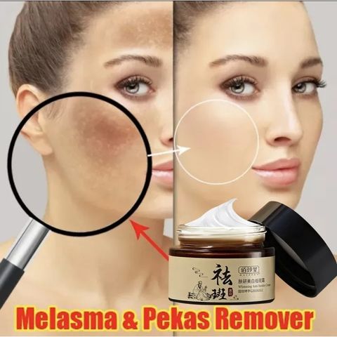 Kem nám tàn nhang chấm tàn nhang kem trắng da mặt 30g Loại bỏ nám tàn nhang làm trắng sáng da dưỡng ẩm da