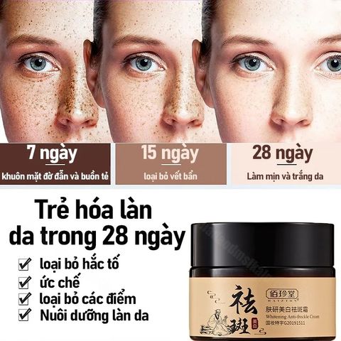 Kem nám tàn nhang chấm tàn nhang kem trắng da mặt 30g Loại bỏ nám tàn nhang làm trắng sáng da dưỡng ẩm da
