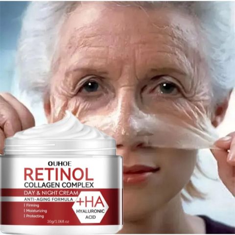Kem dưỡng Retinol Kem nám tàn nhang chấm tàn nhang kem trắng da mặt 30g Loại bỏ nám tàn nhang làm trắng sáng da dưỡng ẩm