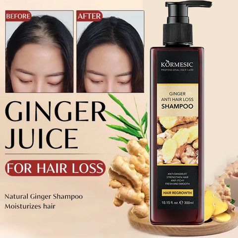 Dầu gội kích thích mọc tóc Dầu gội mọc tóc Giảm Gãy Rụng Dầu Gội Mọc Tóc Nhanh kiểm soát dầu loại bỏ gàu