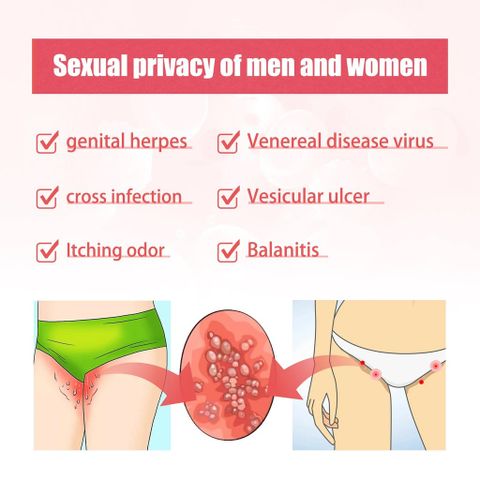 Kem Chống Ngứa & Khử Mùi Vùng Kín - Giải Pháp Toàn Diện Chăm Sóc Vùng Kín Hàng Ngày - Ngăn Ngừa Nấm Tái Phát 20g