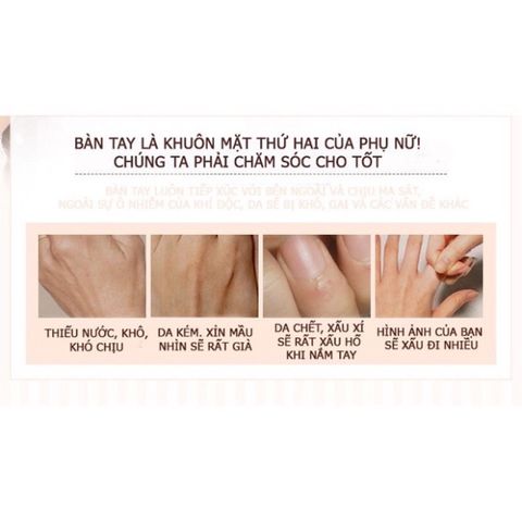 Combo 3 Tuýp KEM DƯỠNG DA TAY