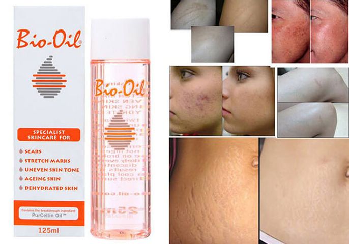 Review tinh dầu Bio Oil là gì? Có tốt không? Giá bao nhiêu?