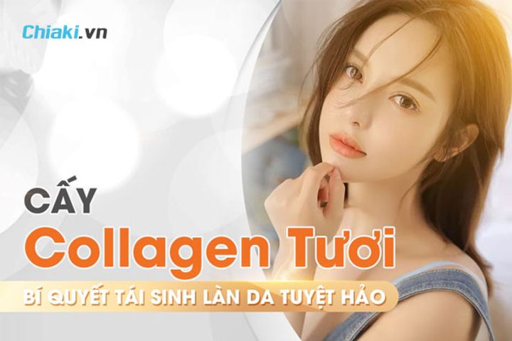 Cấy Collagen Tươi Là Gì? Có Tốt Không Và Những Điều Cần Biết