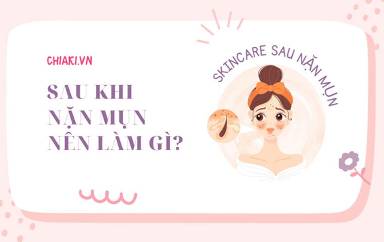 Sau khi nặn mụn xong nên làm gì? Cách skincare sau khi nặn mụn