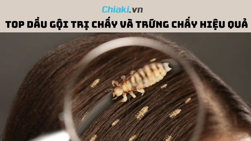 Top 5 dầu gội trị chấy và trứng chấy hiệu quả hiện nay