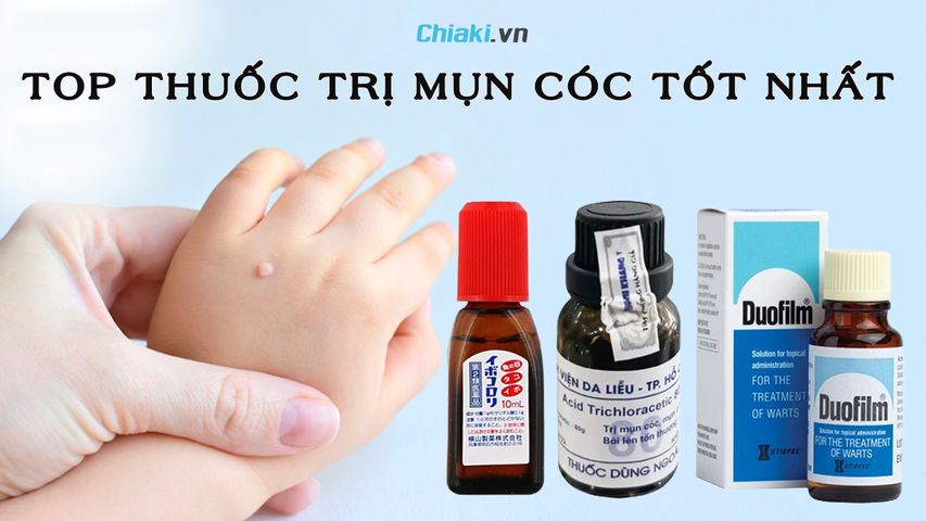Top 10 thuốc trị mụn cóc an toàn và hiệu quả hiện nay