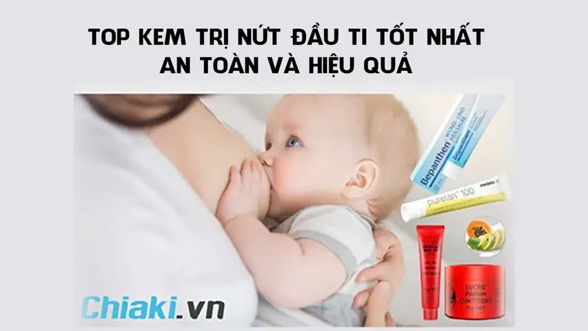 Top 7 kem trị nứt đầu ti chất lượng, an toàn và hiệu quả hiện nay
