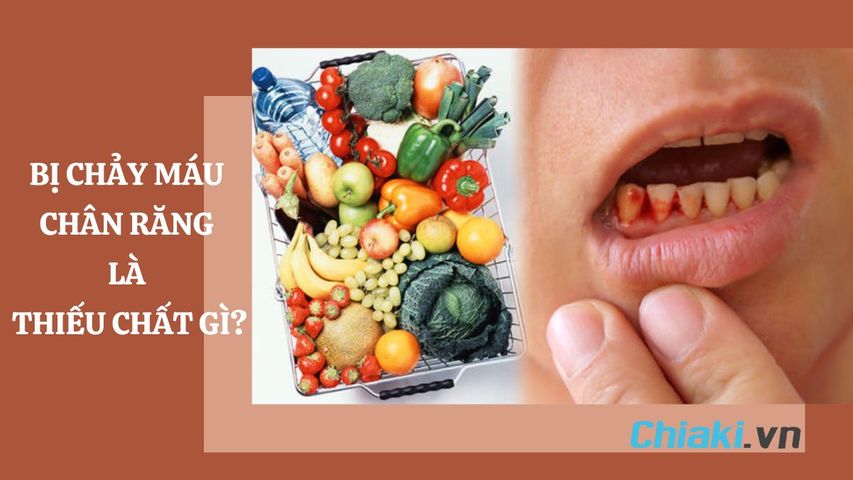 Bị chảy máu chân răng là thiếu chất gì? Nên bổ sung gì?