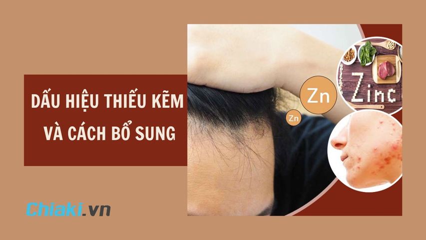 Dấu hiệu thiếu kẽm nguy hiểm và cách bổ sung kẽm hiệu quả
