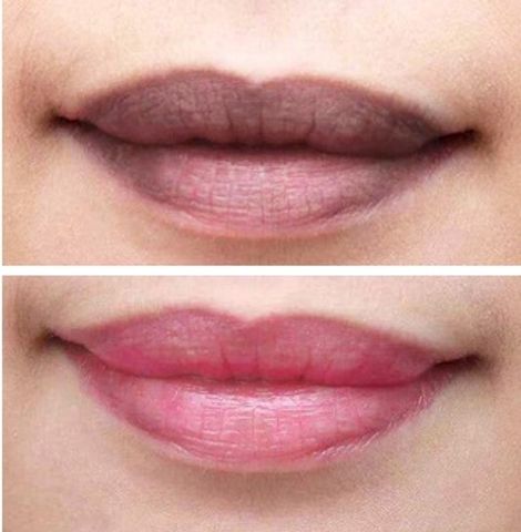 Son Dưỡng Labocare Panteno Lips Hàn Quốc 10ml - Cải Thiện Thâm Môi, Cấp Ẩm Hiệu Quả, Dưỡng Mềm Mịn, Phục Hồi Môi Tự Nhiên