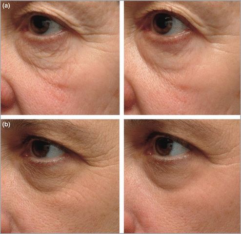 Kem Dưỡng Da Kose Q10 Vital Age 40g - Giúp Chống Lão Hóa, Cung Cấp Độ Ẩm và Tái Tạo Da, Phù Hợp Với Mọi Loại Da