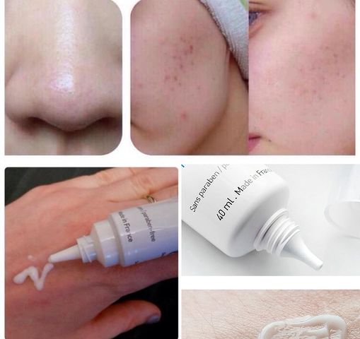 Kem Trị Mụn La Roche Posay Effaclar Duo+ 40ml - Giúp Làm Sạch Da, Ngăn Ngừa Mụn Hiệu Quả Với Niacinamide và LHA