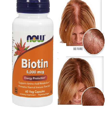 Viên uống hỗ trợ mọc tóc NOW Foods Biotin 5000mcg - Tăng cường sức khỏe tóc, giúp tóc chắc khỏe và dày hơn, sản phẩm chính hãng Mỹ.