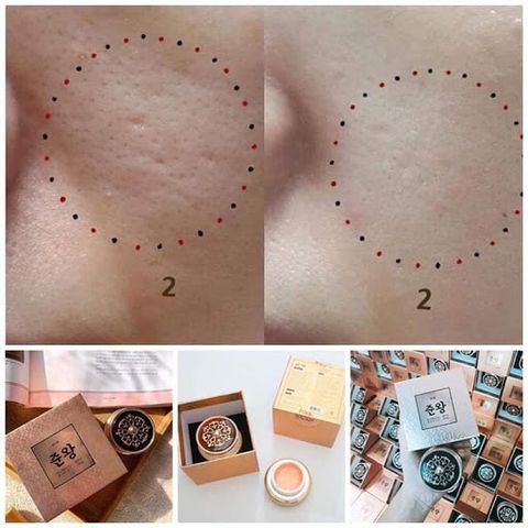 Kem Trị Sẹo Rỗ Đông Y Genie Non Fix Skin - Hỗ Trợ Tái Tạo Da, Cải Thiện Nếp Nhăn, Đầu Da Mềm Mại, Chiết Xuất Thiên Nhiên 30g