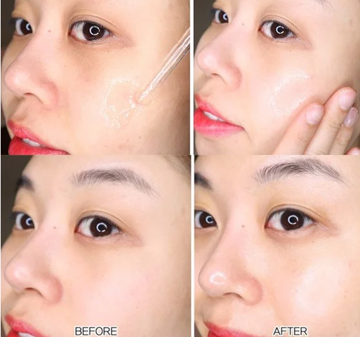 Serum Dưỡng Phục Hồi Da La Roche-Posay Hyalu B5 30ml, 50ml - Cấp ẩm, Giảm Nếp Nhăn, Tái Tạo Da Mịn Màng