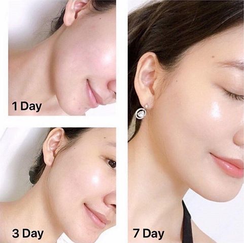 Set Kem Dưỡng Olay Total Effects 7 in 1 Ngày và Đêm - Dưỡng Da Chống Lão Hóa, Đều Màu Da, SPF 15, 2 Lọ 37ml