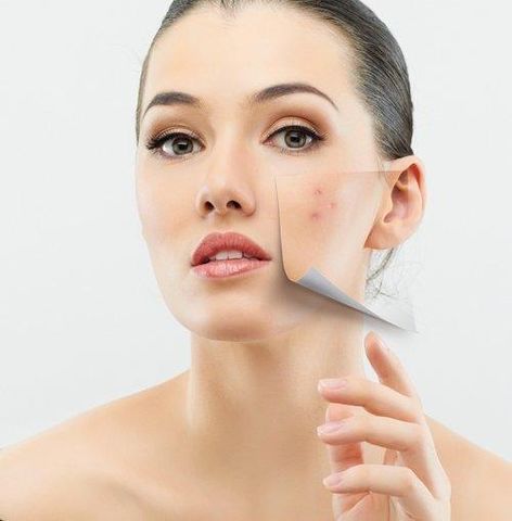 Kem Giảm Mụn Farmona Dermacos Anti Acne Matting Cream 50ml - Hỗ Trợ Điều Trị Mụn, Kháng Viêm, Giảm Bóng Nhờn Da