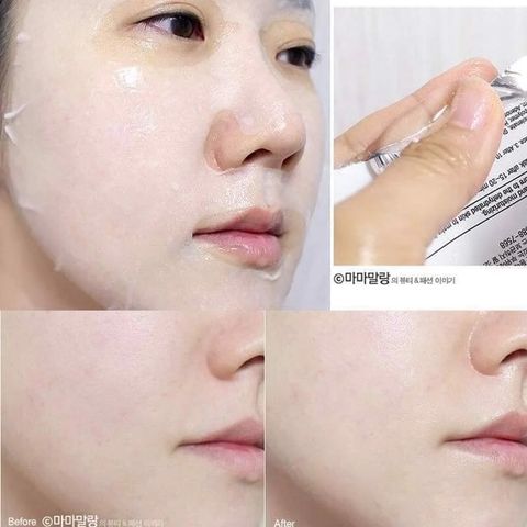 Mặt Nạ BNBG Vitamin A 20.000ppm - Hỗ Trợ Nâng Cơ, Trẻ Hóa Da Từ Cây Xương Rồng Jeju - Giúp Da Sáng Hồng Tự Nhiên, 10 Miếng