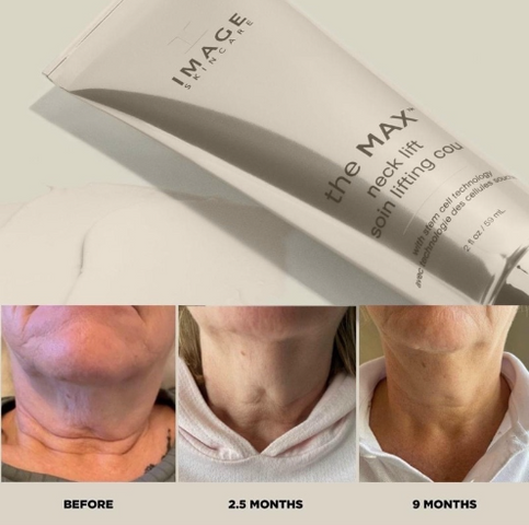 Kem Dưỡng Săn Chắc Vùng Da Cổ và Ngực Image The Max Neck Lift 59ml - Tăng Cường Độ Đàn Hồi, Dưỡng Ẩm, Chống Nhăn