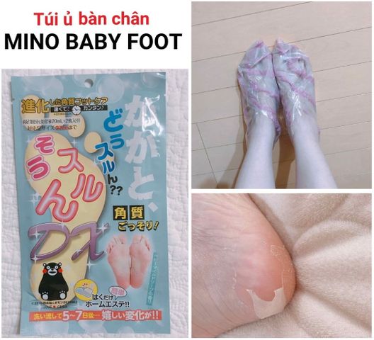 Túi ủ chân tẩy da chết Mino Baby Foot - Giúp làm mềm da chai cứng, loại bỏ mùi hôi, ủ chân hương oải hương và hoa hồng, 2 túi/gói