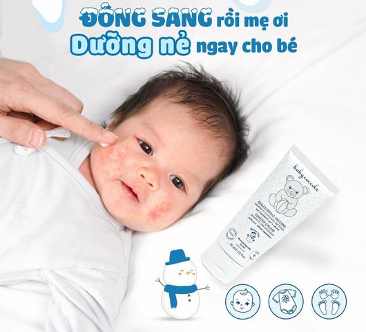 Kem Nẻ và Giữ Ẩm Sáp Ong Babycoccole 75ml - Dưỡng Ẩm Chống Nứt Nẻ Cho Bé Từ Sơ Sinh, An Toàn Cho Da Nhạy Cảm