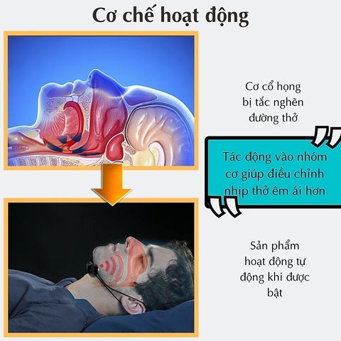 Máy Hỗ Trợ Giảm Ngủ Ngáy & Điều Hòa Nhịp Thở CTFAST - Giấc Ngủ Ngon Lành, Thiết Kế Gọn Nhẹ, Công Nghệ Cấp Khí Tiên Tiến