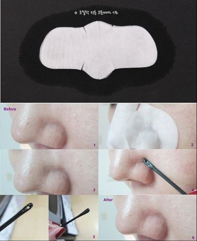 Miếng Serum Đẩy Mụn Đầu Đen Ciracle Goodbye Blackhead - Mặt Nạ Chăm Sóc Da Hàn Quốc, Giúp Làm Sạch Lỗ Chân Lông Hiệu Quả