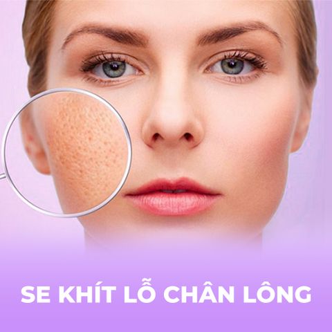 Tinh Chất BHA20 Peel Radiance Beauva - Hỗ Trợ Se Khít Lỗ Chân Lông, Làm Mờ Thâm, Dưỡng Da Mịn Màng, 60ml