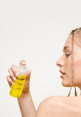 Xịt Hỗ Trợ Cải Thiện Mụn Acnemy Zitback 80ml - Sản Phẩm Chăm Sóc Da Tiện Lợi Giúp Giảm Mụn Lưng, Mụn Ngực, Được Sản Xuất Tại Tây Ban Nha