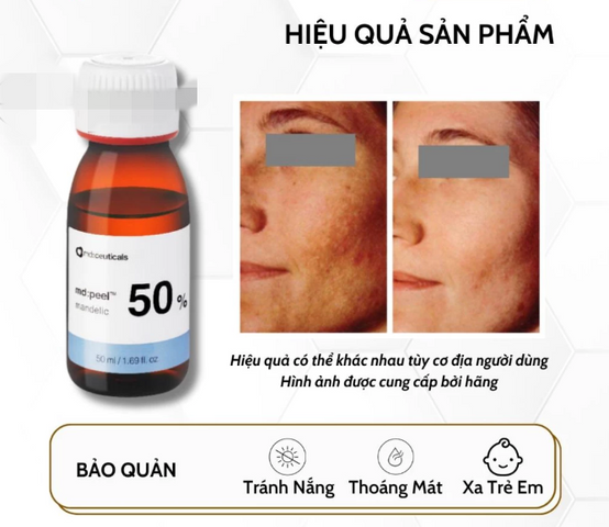 Dung Dịch Thay Da Sinh Học MD:Ceuticals Peel Mandelic 50% - Giải Pháp Làm Sáng Da, Giảm Thâm và Nám, Trẻ Hóa Da Hiệu Quả