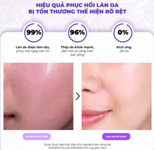 Tinh chất ốc sên Tiam Snail & Azulene Essence 180ml - Serum làm dịu và phục hồi da nhạy cảm, cấp ẩm tự nhiên hiệu quả