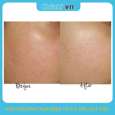 Serum Estee Lauder Advanced Night Repair 50ml - Phục hồi da, giảm nếp nhăn, tăng độ đàn hồi và làm đều màu da, chống lão hóa hiệu quả.