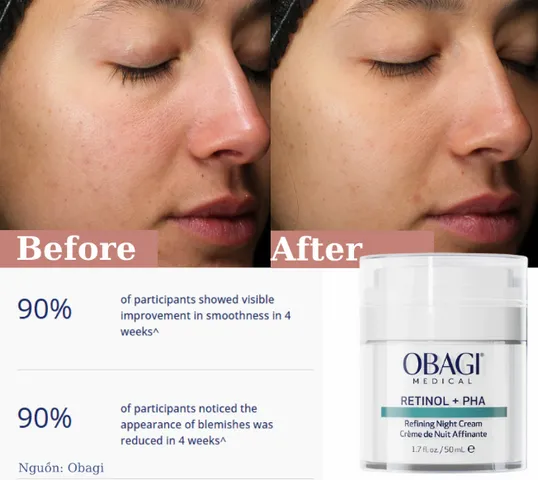 Kem Dưỡng Ẩm Tái Tạo Da Ban Đêm Obagi Medical Retinol + PHA 50ml - Giúp Cải Thiện Mụn, Lỗ Chân Lông, Và Giữ Ẩm Rạng Rỡ
