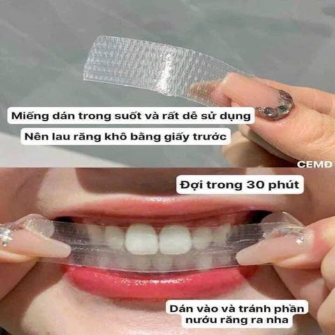Set 2 Hộp Miếng Dán Trắng Răng Crest 3D Whitestrips (40 Miếng + 20 Miếng)
