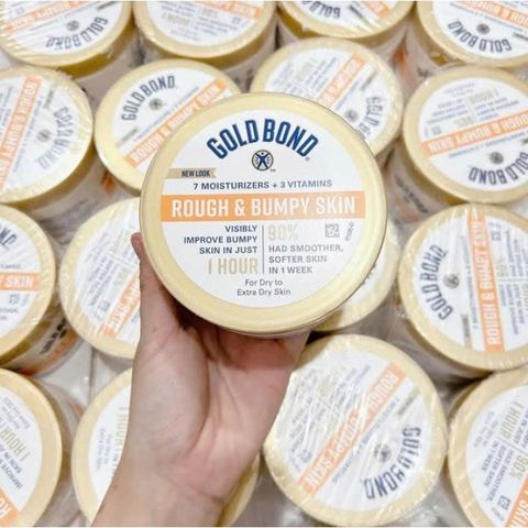Kem Dưỡng Da Gold Bond Rough & Bumpy Skin - Cho Da Khô, Sần, Dày Sừng, Làm Mịn Da, Fullsize 226g Nhập Mỹ