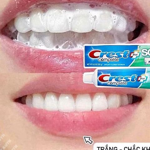 Set 5 Kem Đánh Răng Crest Bạc Hà Trà Xanh - Giải Pháp Chăm Sóc Răng Miệng Từ Thiên Nhiên, Ngăn Ngừa Sâu Răng, Thơm Mát Hơi Thở