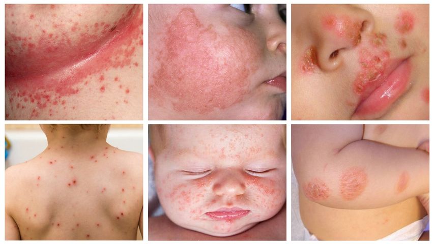 Combo 3 Nước Tắm Cho Bé Dr Baby Giảm Rôm Sảy, Mẩn Ngứa, Hăm Tã