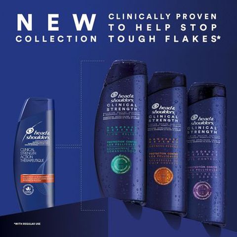 Dầu Gội Làm Sạch Gàu Head & Shoulders Clinical Strength 400ml - Giảm Ngứa và Kiểm Soát Dầu, Phục Hồi Da Đầu Khỏe Mạnh