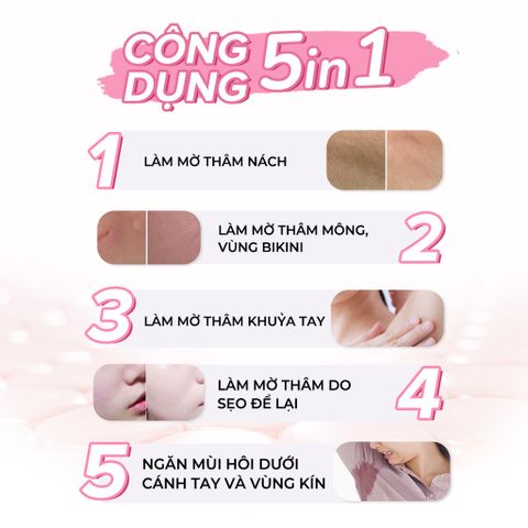 Serum mờ thâm nách, bẹn, mông Oriskin Sakina White