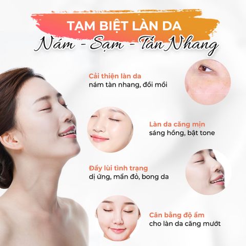Kem Hỗ trợ Ngừa Nám Tàn Nhang Oriskin Melasma Whitening Cream